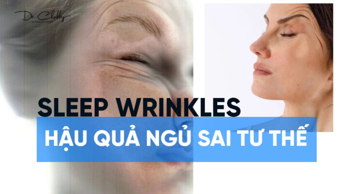 Sleep wrinkles Hau qua cua viec ngu sai tu the